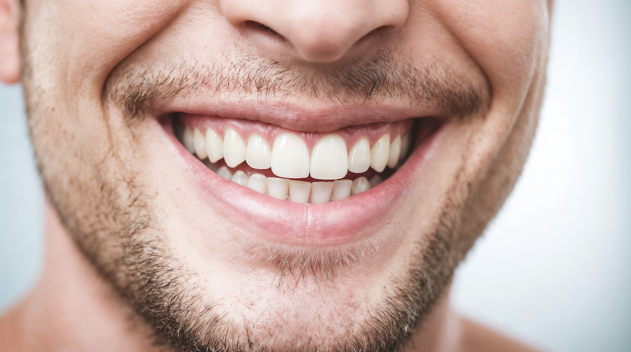 abceso dental
